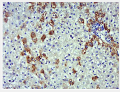 Anti-iNOS antibody-一氧化氮合成酶-2（诱导型）抗体,iNOS