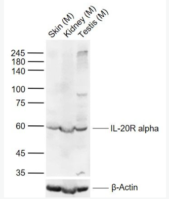 Anti-IL-20R alpha antibody-白介素20受体α链抗体,IL-20R alpha