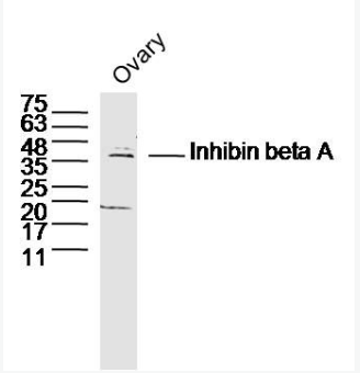 Anti-Inhibin beta A antibody-抑制素βA/Inhibin βA抗体,Inhibin beta A