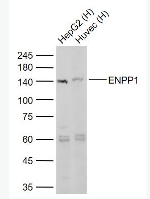 Anti-ENPP1 antibody-核苷酸内焦磷酸酶/磷酸二酯酶1抗体,ENPP1