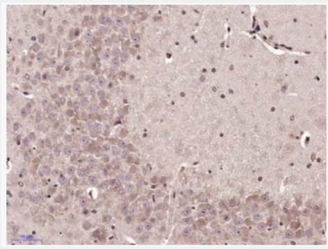 Anti-MCP3 antibody-单核细胞趋化蛋白3抗体,MCP3