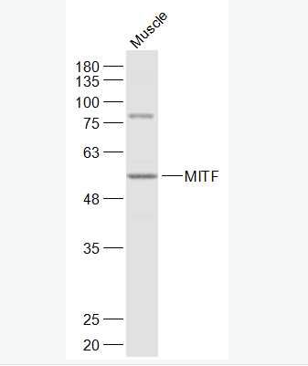 Anti-MITF antibody-微小细胞血症相关转录因子抗体,MITF