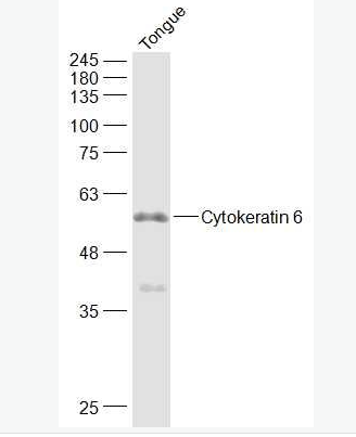 Anti-Cytokeratin 6 antibody-细胞角蛋白6抗体,Cytokeratin 6