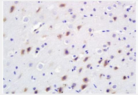 Anti-BDKRB2 antibody-緩激肽B2受體抗體,BDKRB2