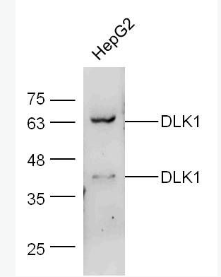 Anti-DLK1 antibody-穿膜蛋白DLK1抗體,DLK1