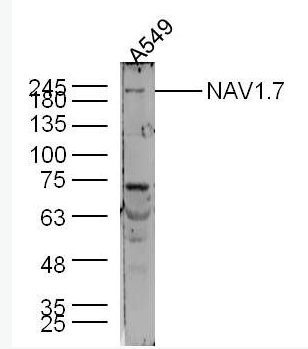 Anti-NAV1.7 antibody-電壓開啟的鈉離子通道SCN9A抗體,NAV1.7