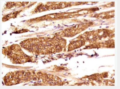 Anti-TEM1 antibody-內(nèi)涎蛋白/內(nèi)皮唾液酸蛋白抗體,TEM1