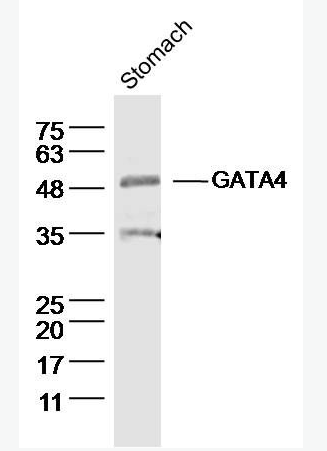 Anti-GATA4  antibody-GATA結(jié)合蛋白4抗體,GATA4