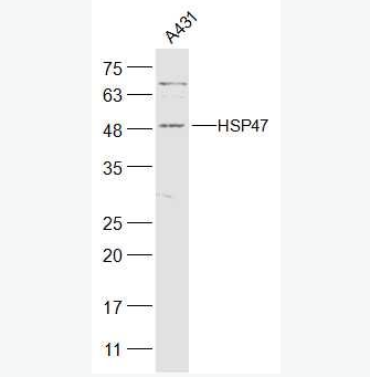 Anti-HSP47 antibody-熱休克蛋白-47抗體,HSP47