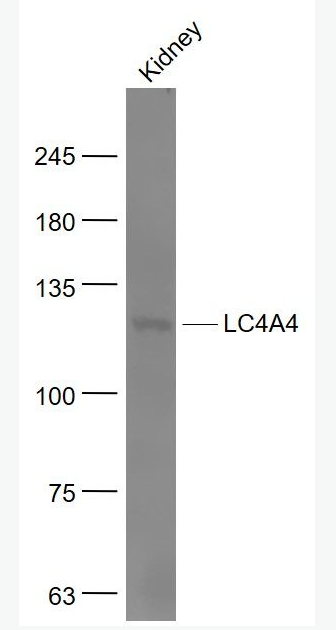 Anti-SLC4A4antibody-碳酸氢钠协同转运蛋白4-A4抗体,SLC4A4