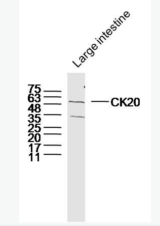 Anti-CK20 antibody-细胞角蛋白20抗体,CK20