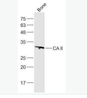 Anti-CA II antibody-碳酸酐酶2抗体,CA II