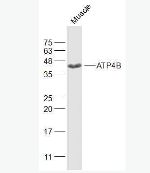 Anti-ATP4B antibody-氫鉀ATP酶通道蛋白抗體,ATP4B