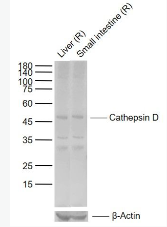 Anti-Cathepsin D antibody-組織蛋白酶D輕鏈抗體,Cathepsin D