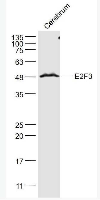 Anti-E2F3 antibody-转录因子E2F-3抗体,E2F3