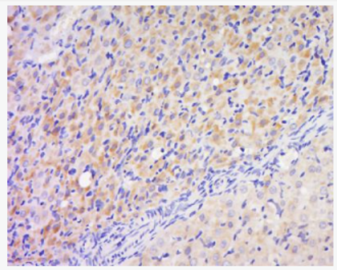 Anti-phospho-PAK2 (Ser141) antibody-磷酸化p21激活激酶2抗体,phospho-PAK2 (Ser141)