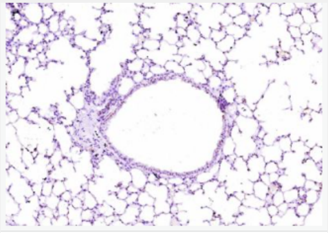 Anti-COL4A3/Tumstatin antibody-肿瘤抑素抗体,COL4A3/Tumstatin