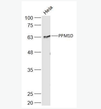 Anti-PPM1D antibody-原癌基因WIP1抗体,PPM1D