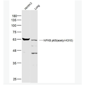 Anti-NFKB p65(acetyl K310) antibody-乙酰化细胞核因子NFKBp65抗体,NFKB p65(acetyl K310)
