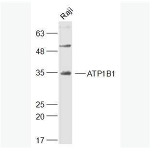 Anti-ATP1B1 antibody-钠钾ATP酶蛋白b1抗体