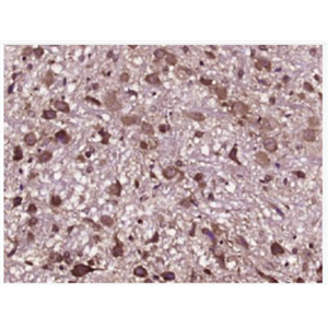 Anti-VDAC antibody-等电压依赖性阴离子通道抗体