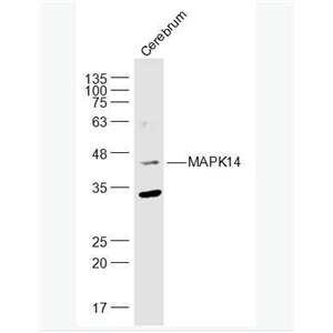 Anti-P38 MAPK/ MAPK14 antibody-丝裂原活化蛋白激酶p38α抗体,P38 MAPK/ MAPK14