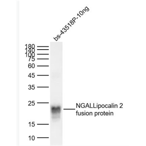 Anti-NGAL/Lipocalin 2 antibody-脂质运载蛋白抗体
