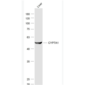 Anti-CYP7A1 antibody-细胞色素P450 7A1抗体/胆固醇7a羟化酶抗体