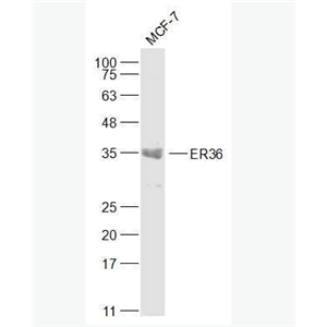 Anti-ER36 antibody-雌激素受体α36抗体