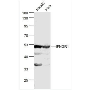 Anti-IFNGR1 antibody-干扰素-gamma受体1抗体,IFNGR1