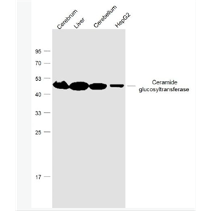 Anti-Ceramide glucosyltransferase antibody-葡萄糖神经酰胺合成酶抗体,Ceramide glucosyltransferase