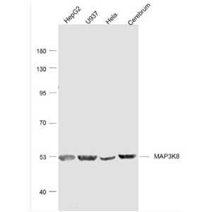 Anti-MAP3K8 antibody-丝裂原活化蛋白激酶激酶8抗体