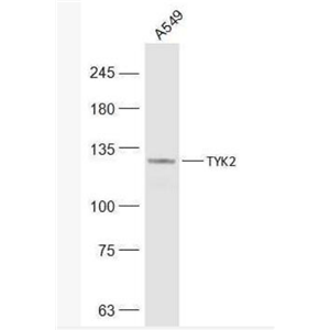 Anti-TYK2 antibody-非受体酪氨酸蛋白激酶2抗体