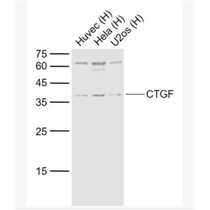 Anti-CTGF antibody-结缔组织生长因子抗体