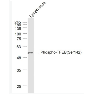 Anti-Phospho-TFEB(Ser142) antibody-磷酸化T淋巴细胞转录调节因子TFEB抗体,Phospho-TFEB(Ser142)