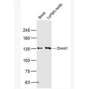 Anti-Dnmt1 antibody-DNA甲基转移酶1抗体