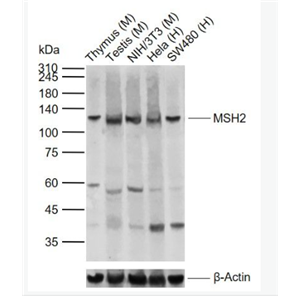 Anti-MSH2 antibody-错配修复蛋白2抗体