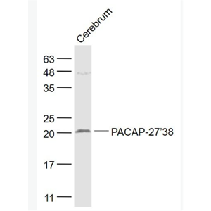 Anti-PACAP-27/38 antibody-腺苷酸环化酶激活肽-27/38抗体,PACAP-27/38