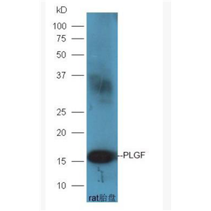 Anti-PLGF antibody-胎盘生长因子抗体