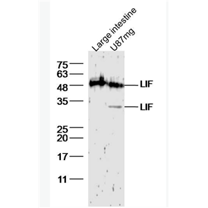 Anti-LIF antibody-白血病抑制因子抗体