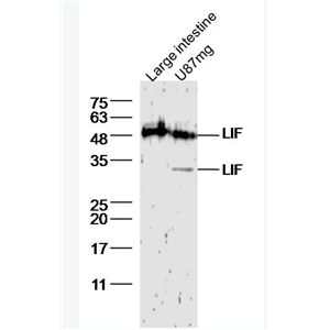 Anti-LIF antibody-白血病抑制因子抗体,LIF