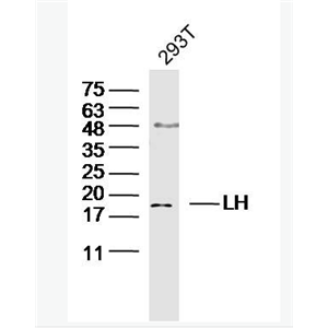 Anti-LHB antibody-促黄体素β亚单位抗体