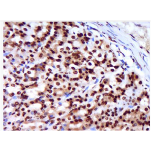 Anti-CCL3  antibody-巨噬细胞炎症因子1α抗体,CCL3