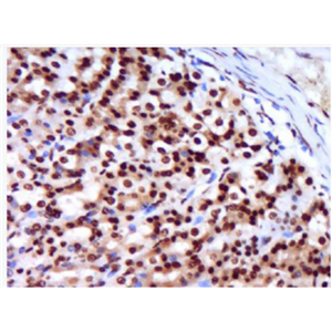 Anti-CCL3  antibody-巨噬細(xì)胞炎癥因子1α抗體