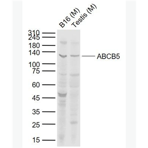 Anti-ABCB5 antibody-ATP结合蛋白家族5抗体