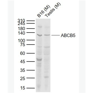 Anti-ABCB5 antibody-ATP结合蛋白家族5抗体,ABCB5