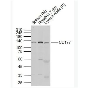 Anti-CD177 antibody-嗜中性粒细胞抗原CD177抗体,CD177