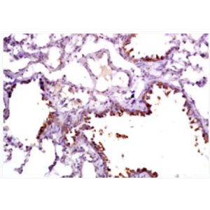 Anti-Uteroglobin antibody-克拉拉细胞蛋白抗体