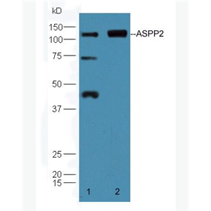 Anti-ASPP2 antibody-P53凋亡刺激蛋白2抗体