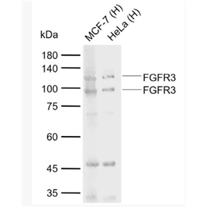 Anti-FGFR3 antibody-成纤维细胞生长因子受体3抗体,FGFR3